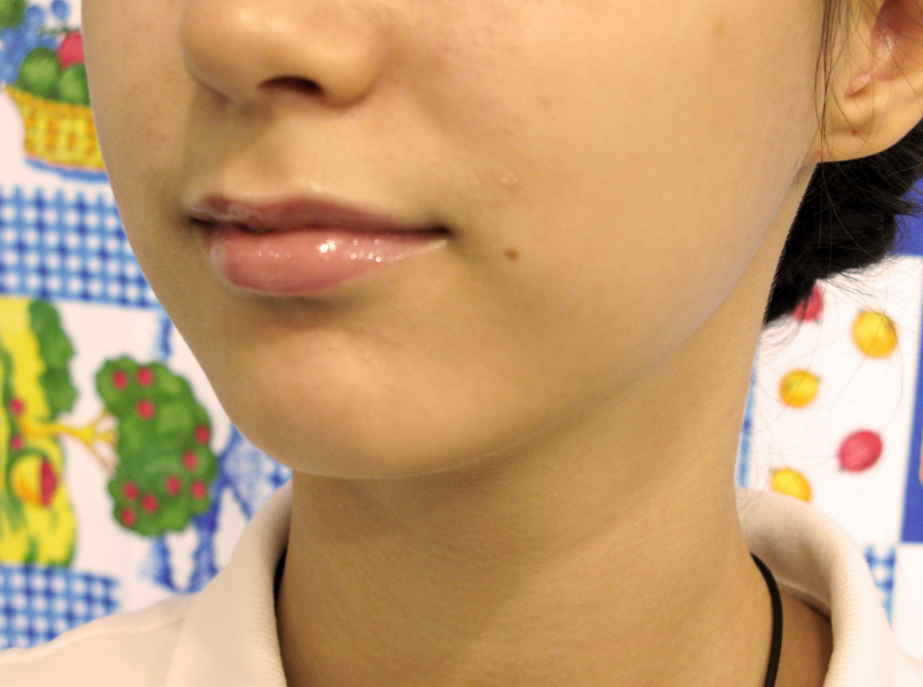 Инновационный бальзам для увеличения губ. Работает, но без чудес ✨