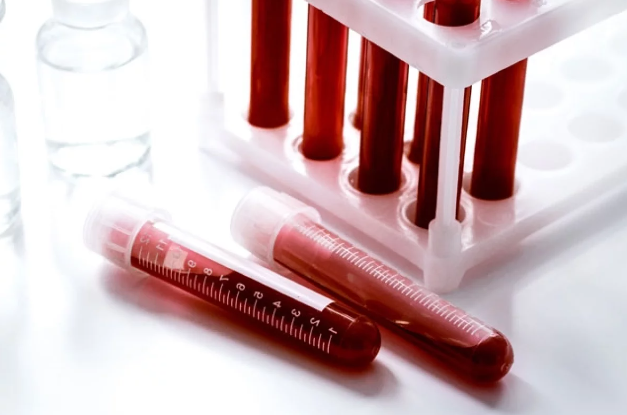 Тайна крови: ученые открыли новую группу крови, которая есть только у 1 человека из 1000