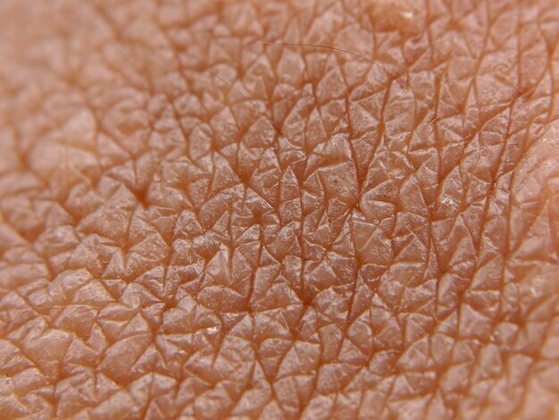 Комбинация клеток и полимеров. В России готовятся к испытаниям искусственной кожи