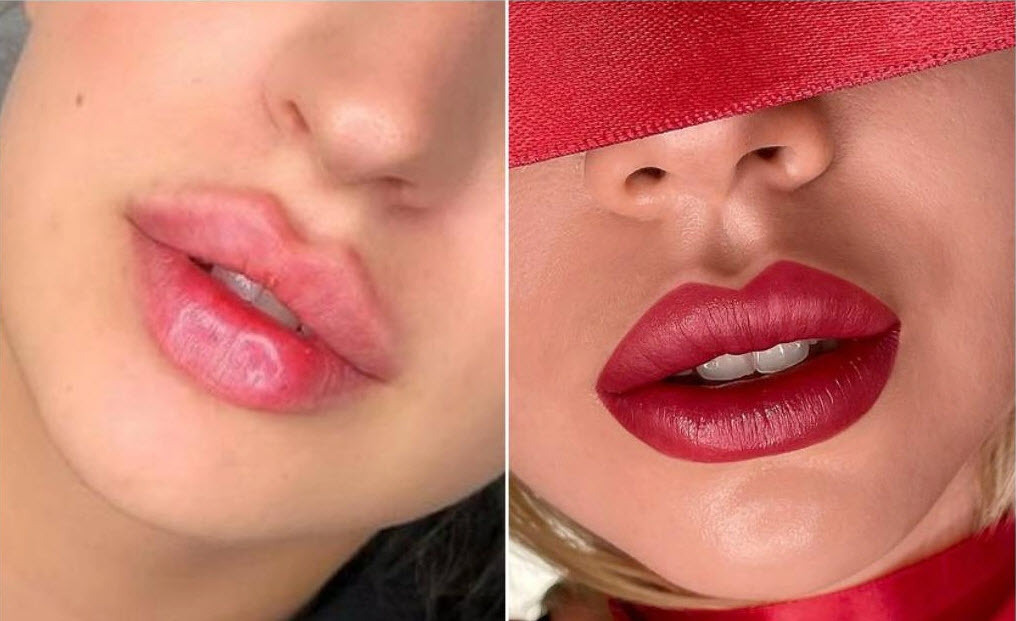 Не поверишь! Губы - "уточки" больше не в тренде. Вот это да! 😲