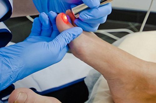 Как избавиться от грибка