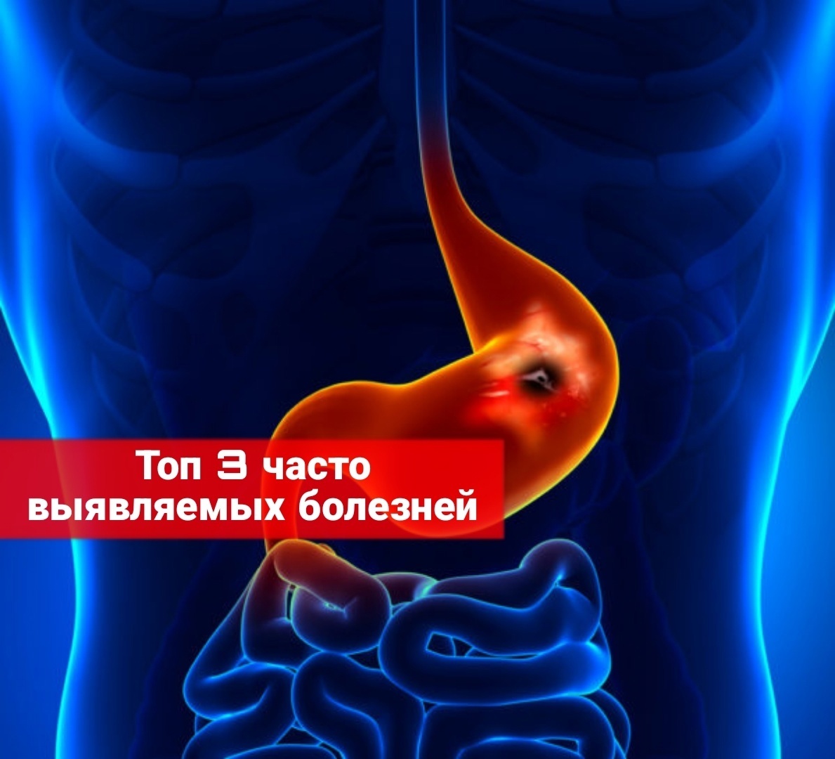 Топ 3 болезни призывника, которые он игнорирует