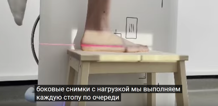 Опять про плоскостопие и опять про доказывание в военкомате