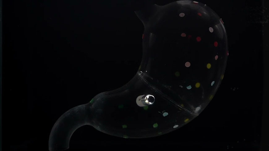 Проглотите робота: крошечная камера может устранить необходимость в ненавистной эндоскопии