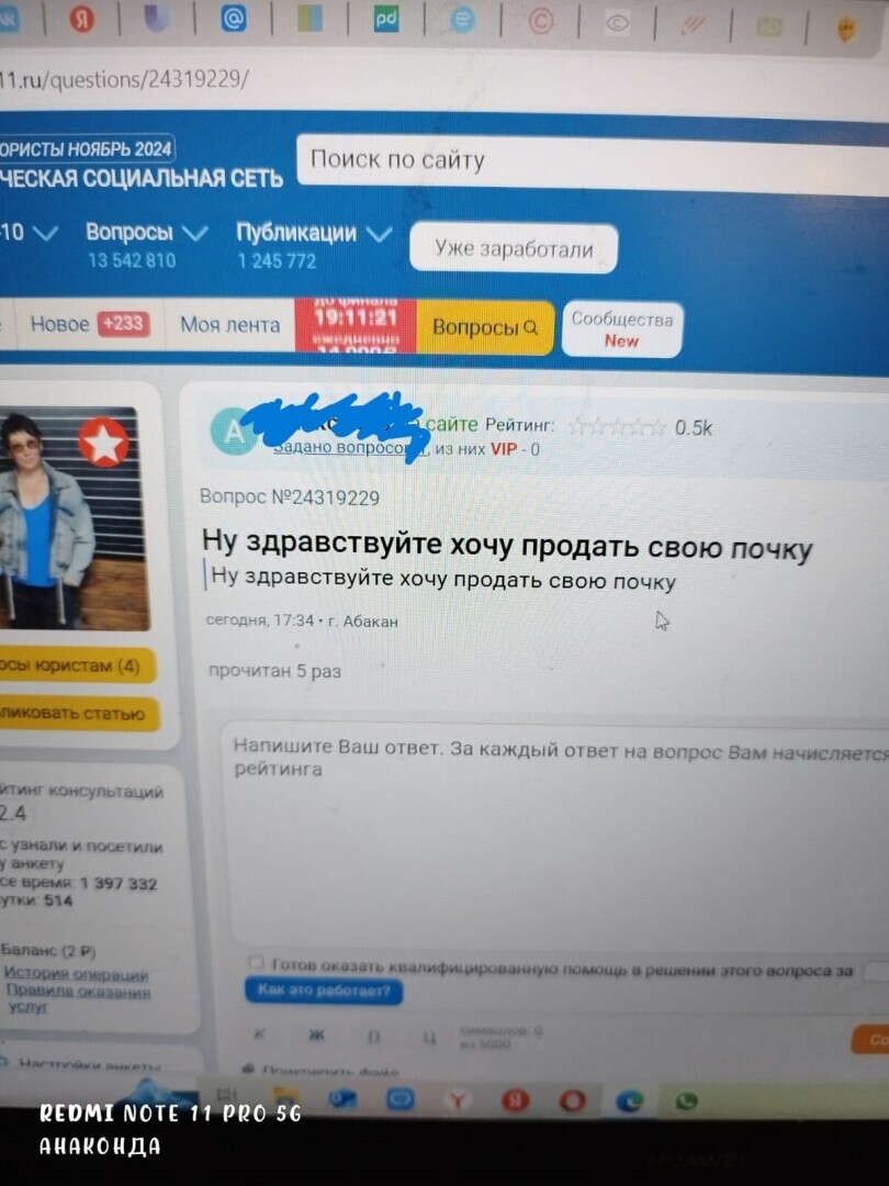 Хотите продать почку - не забудьте ознакомиться с этой информацией. Инструктирует юрист