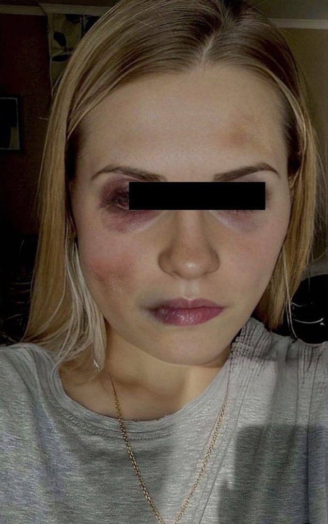 😡😡 КОШМАР! В Приморье иностранец сильно избил девушку после предложения обвенчаться