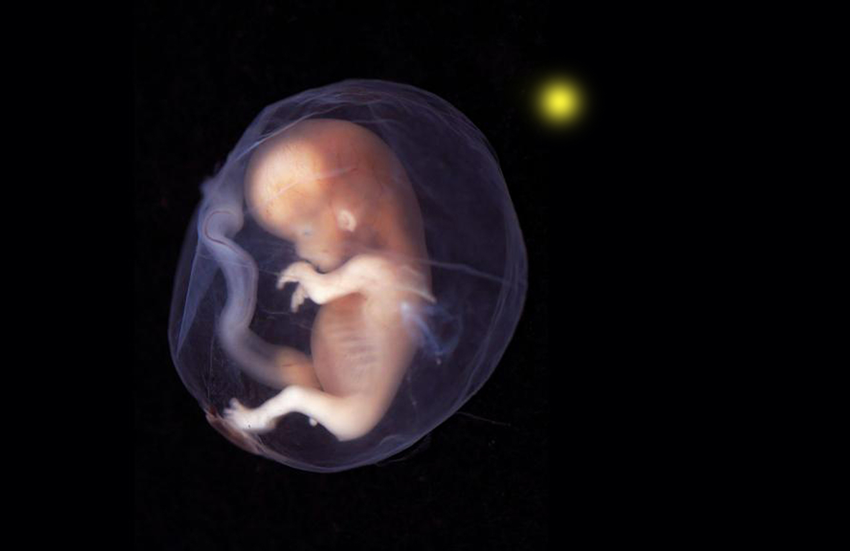 Всё о т.н. "точке сборки". Её уже раскрытые тайны и секреты ещё совсем неизвестные! Карлос Кастанеда +. Глава третья