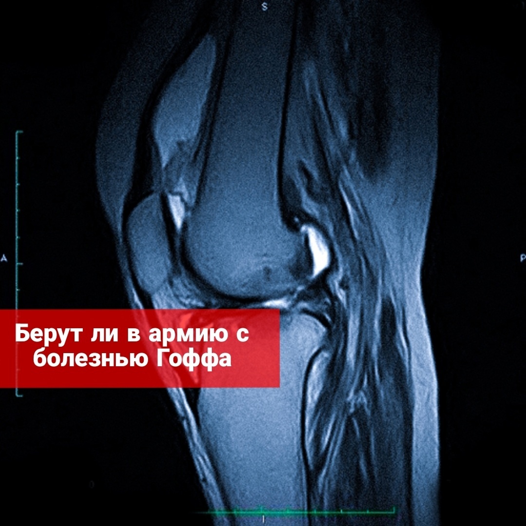 Берут ли в армию с болезнью Гоффа