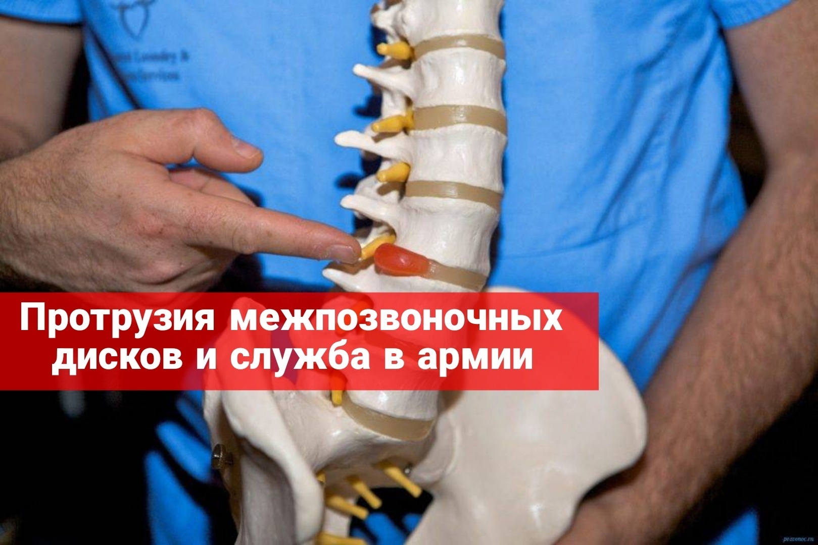 Протрузия межпозвоночных дисков и служба в армии