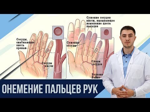 Причины онемения кончиков пальцев на руках.