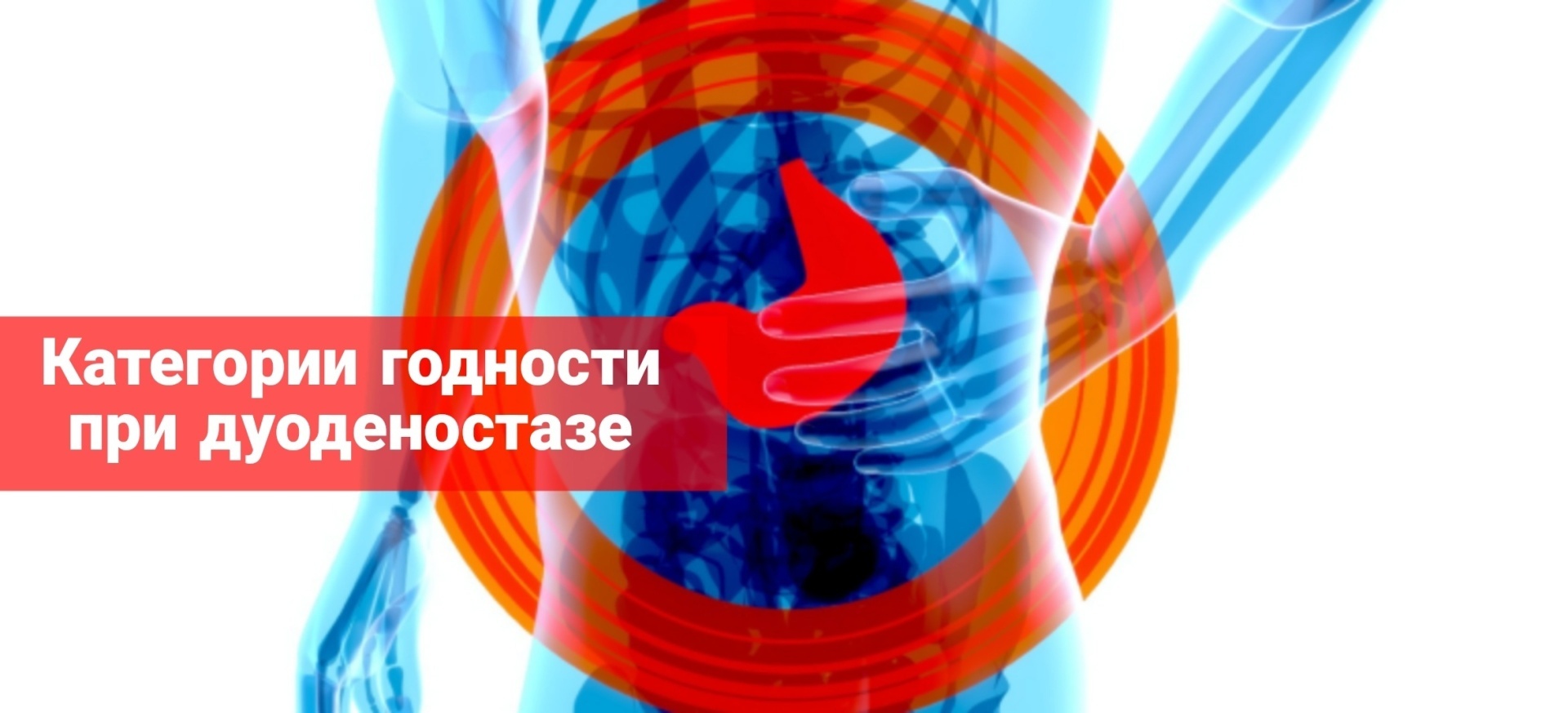Категории годности при дуоденостазе