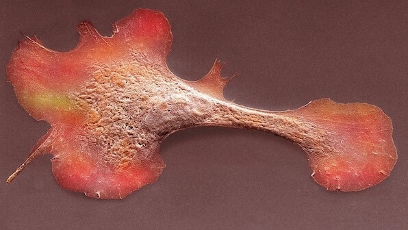 Ученые разработали заплатку для восстановления сердца: почему это новаторство