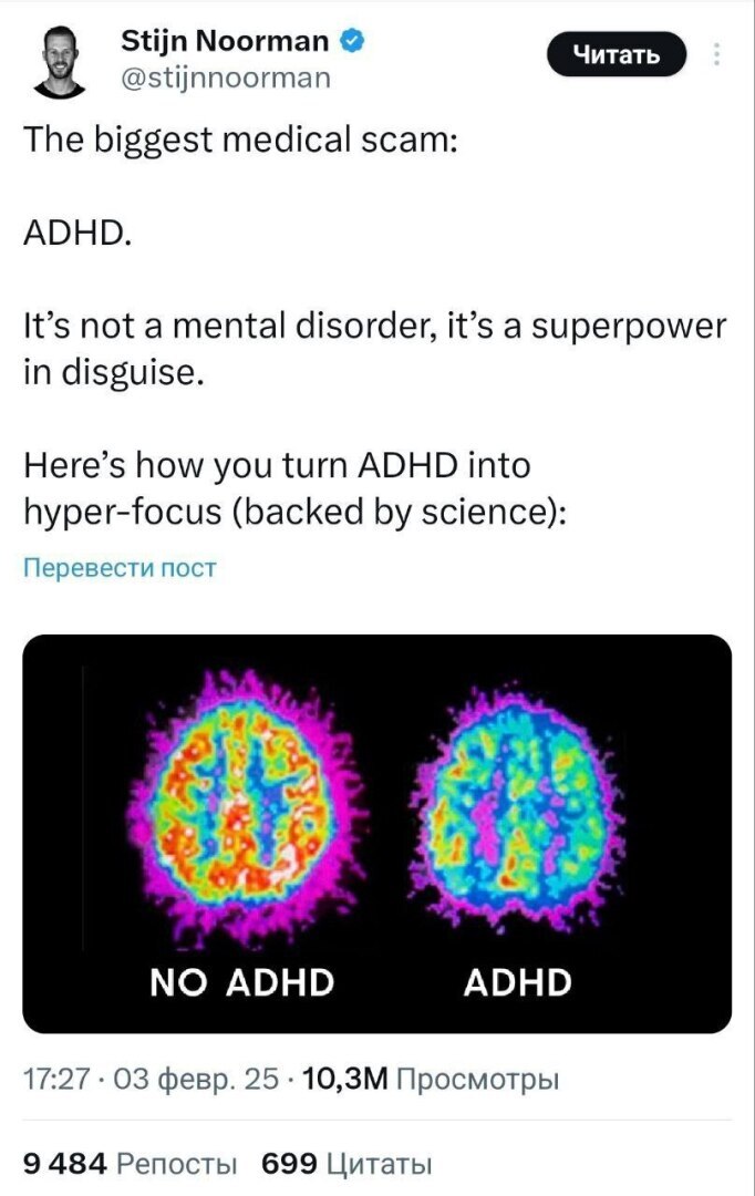 СДВГ - не болезнь, а скрытая суперсила : врач рассказал, что СДВГ можно использовать себе на пользу