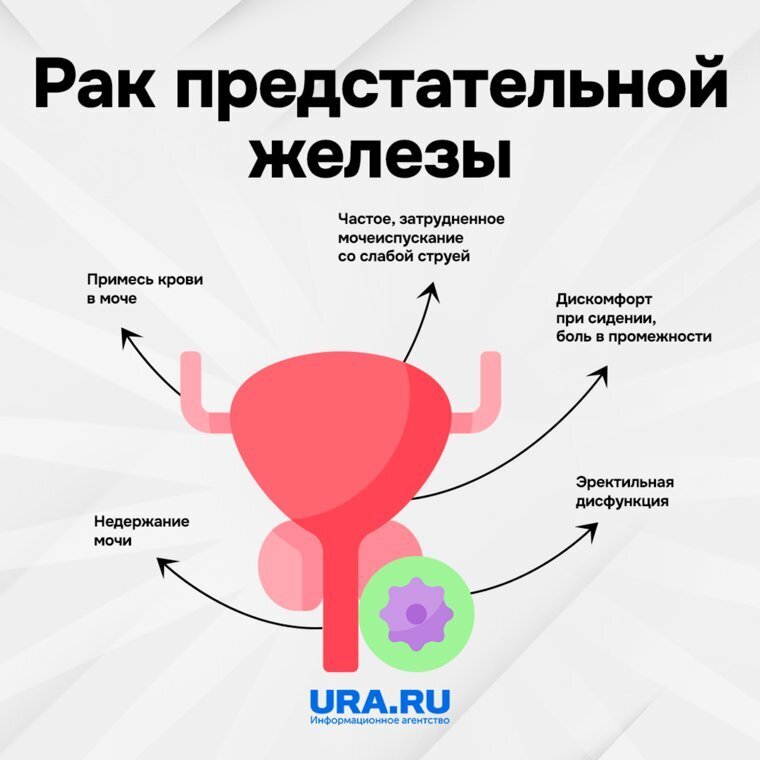 Как распознать рак