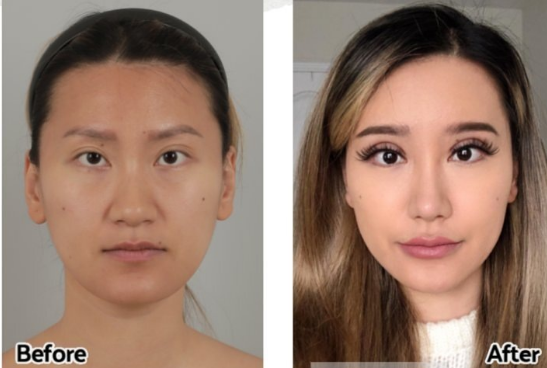 Корейские стандарты красоты: деньги на пластические операции в честь 18-летия, что за этим стоит?