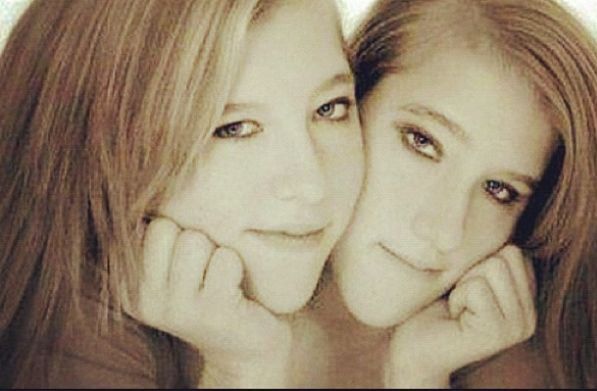 Тело не разделилось. В Бийске врач УЗИ обнаружил у беременной необычных сиамских близнецов