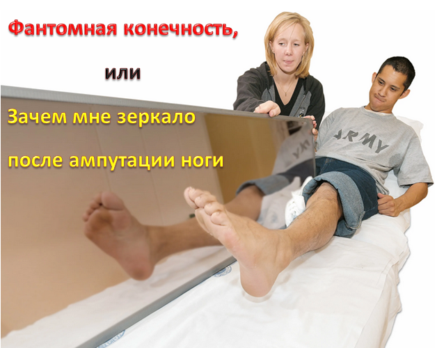 Фантомная конечность, или Зачем мне зеркало после ампутации ноги