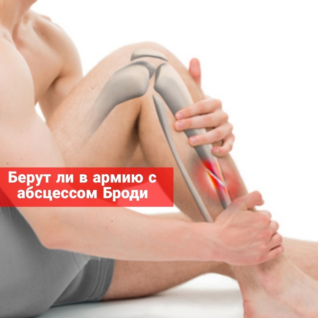 Берут ли в армию с абсцессом Броди