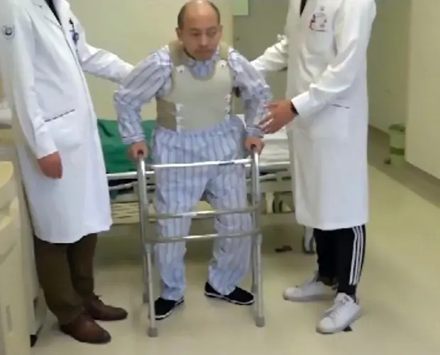 «Сложенный мужчина» выпрямился спустя 28 лет после операции, изменившей его жизнь, из-за редкого заболевания