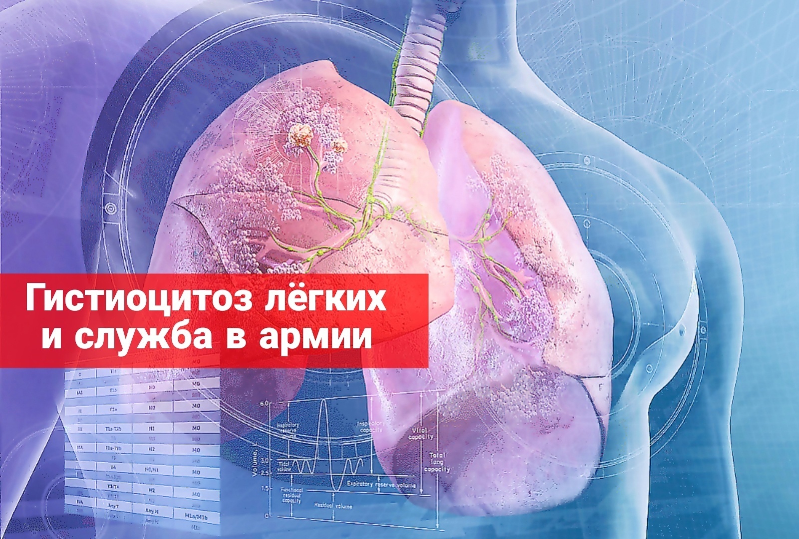 Гистоцитоз легких и служба в армии
