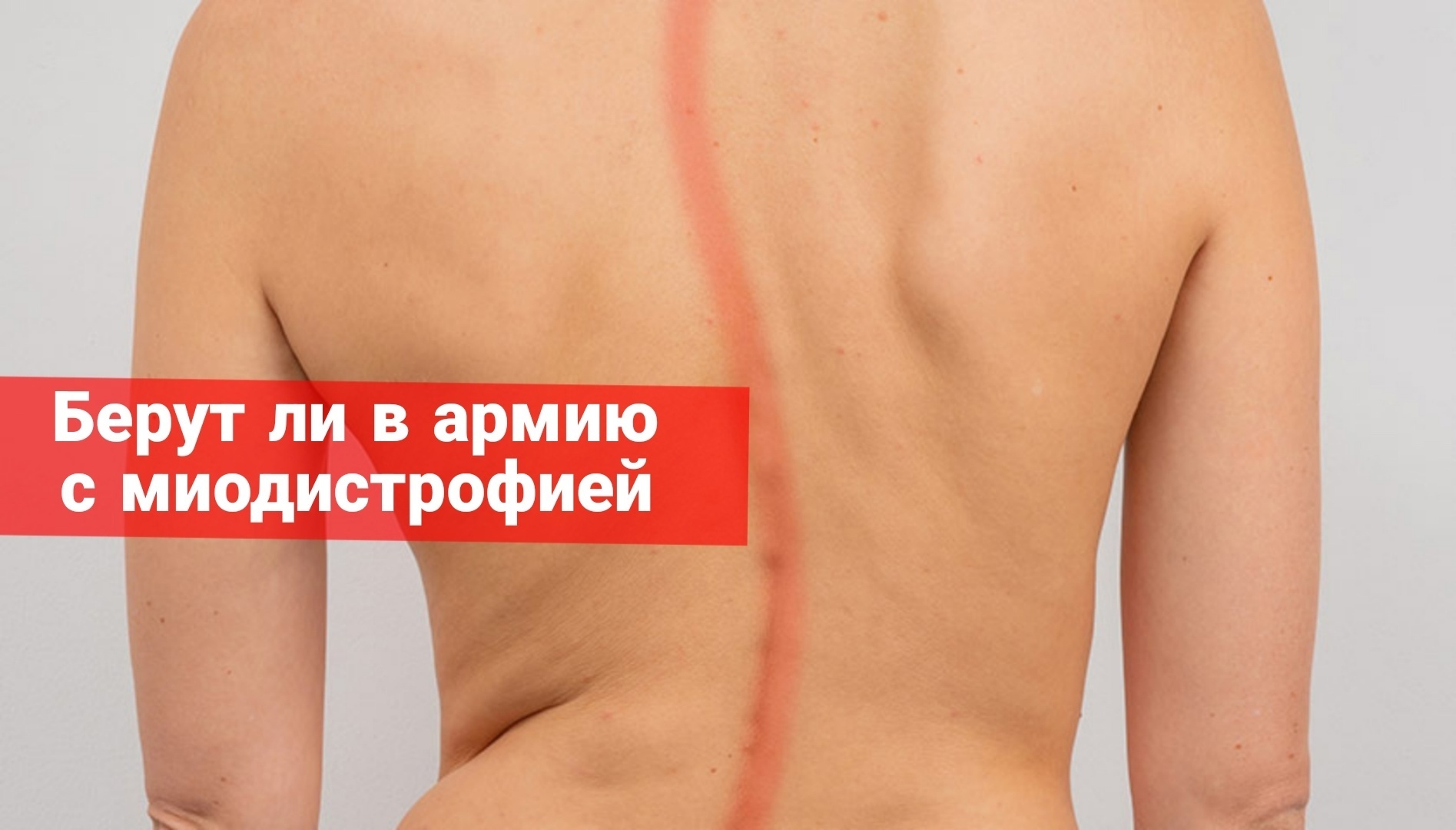 Берут ли в армию с миодистрофией