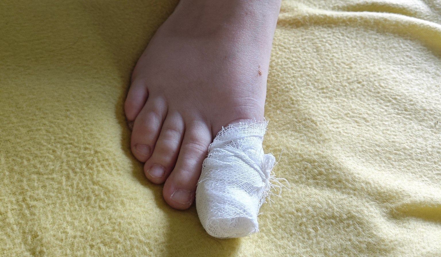 Подозреваю, что врастания ногтя не было, или Чем закончился мой поход к хирургу