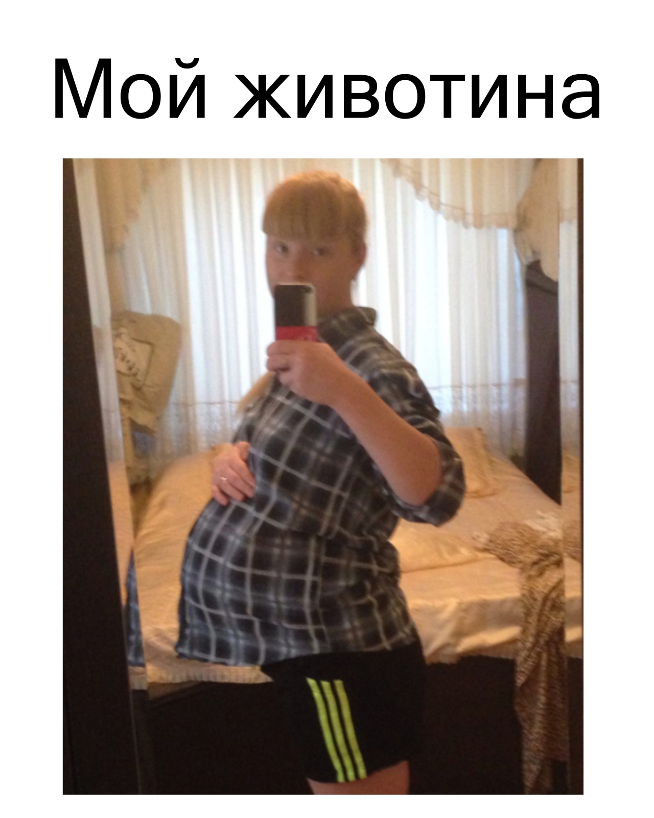 Турецкий гинеколог залез мне под бикини: "О Аллах, что это такое???Вы зачем это сделали?", но у меня был для него ещё один сюрприз