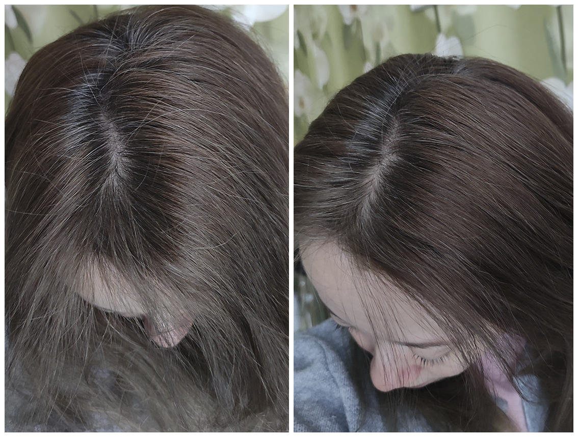 Мой путь отращивания волос сединой: часть 2. Не крашу волосы краской 2,5 месяца