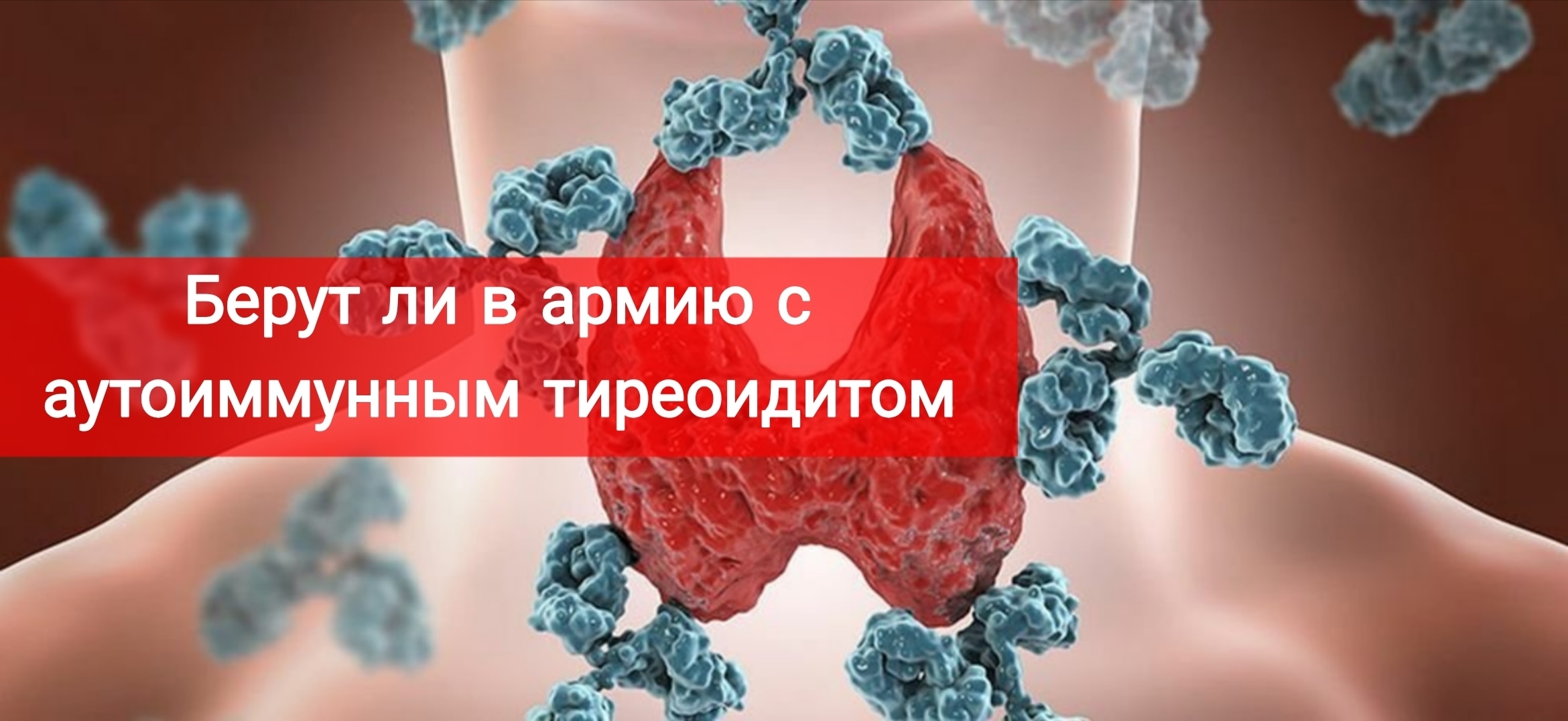 Берут ли в армию с аутоиммунным тиреоидитом
