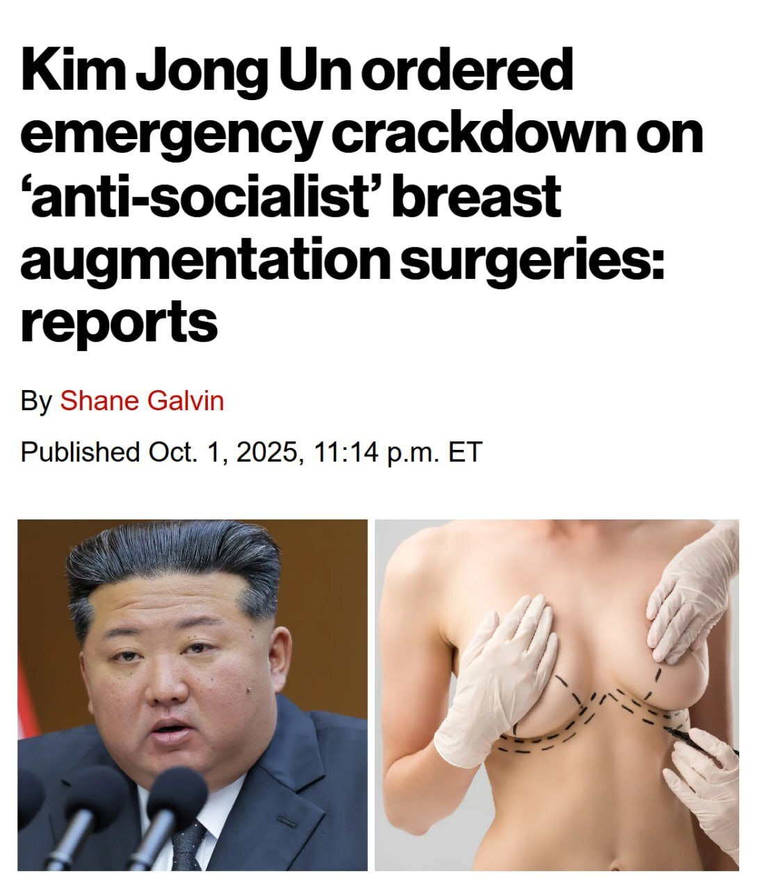 В Северной Корее ввели УГОЛОВКУ за силиконовую грудь
