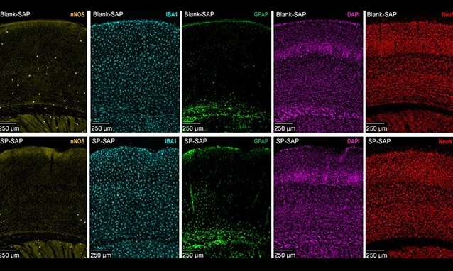 Нейроны, чувствительные к стрессу, могут оказывать мощное воздействие на весь наш мозг