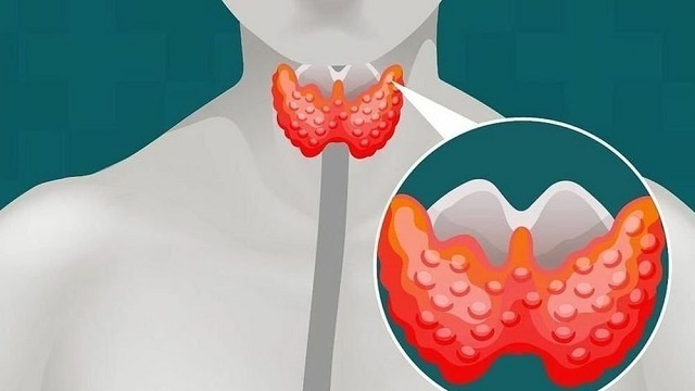 Почему важно контролировать гормоны щитовидной железы?