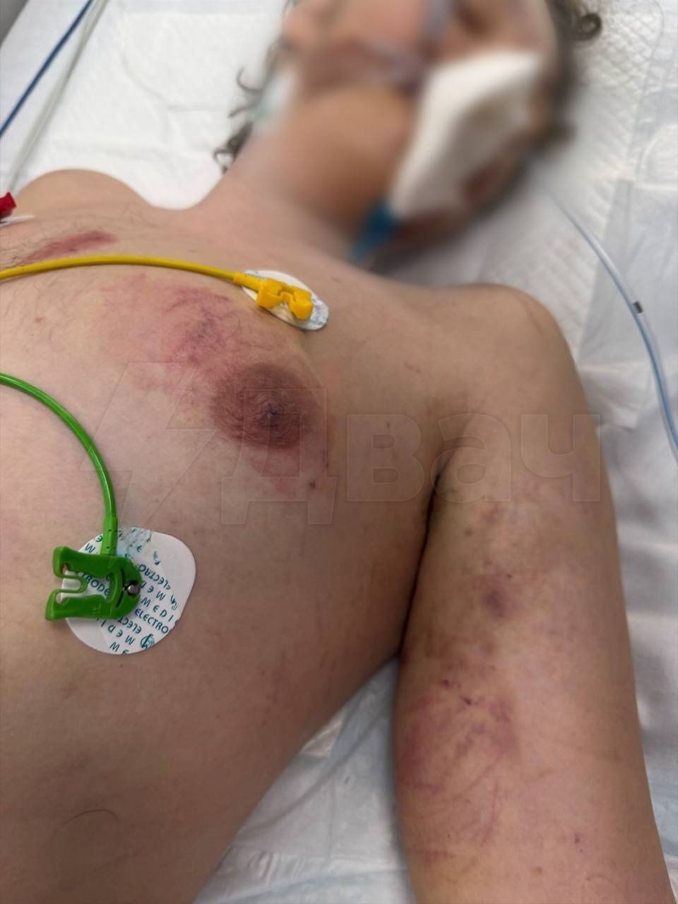 Вы слышали что, Ад под видом рехаба в Подмосковье