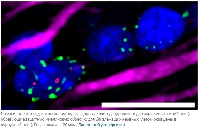 Сокращения калорий на 30 % может быть достаточно, чтобы защитить мозг от старения