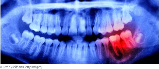 Эксперт обнаружил удивительную связь между здоровьем полости рта и работой мозга