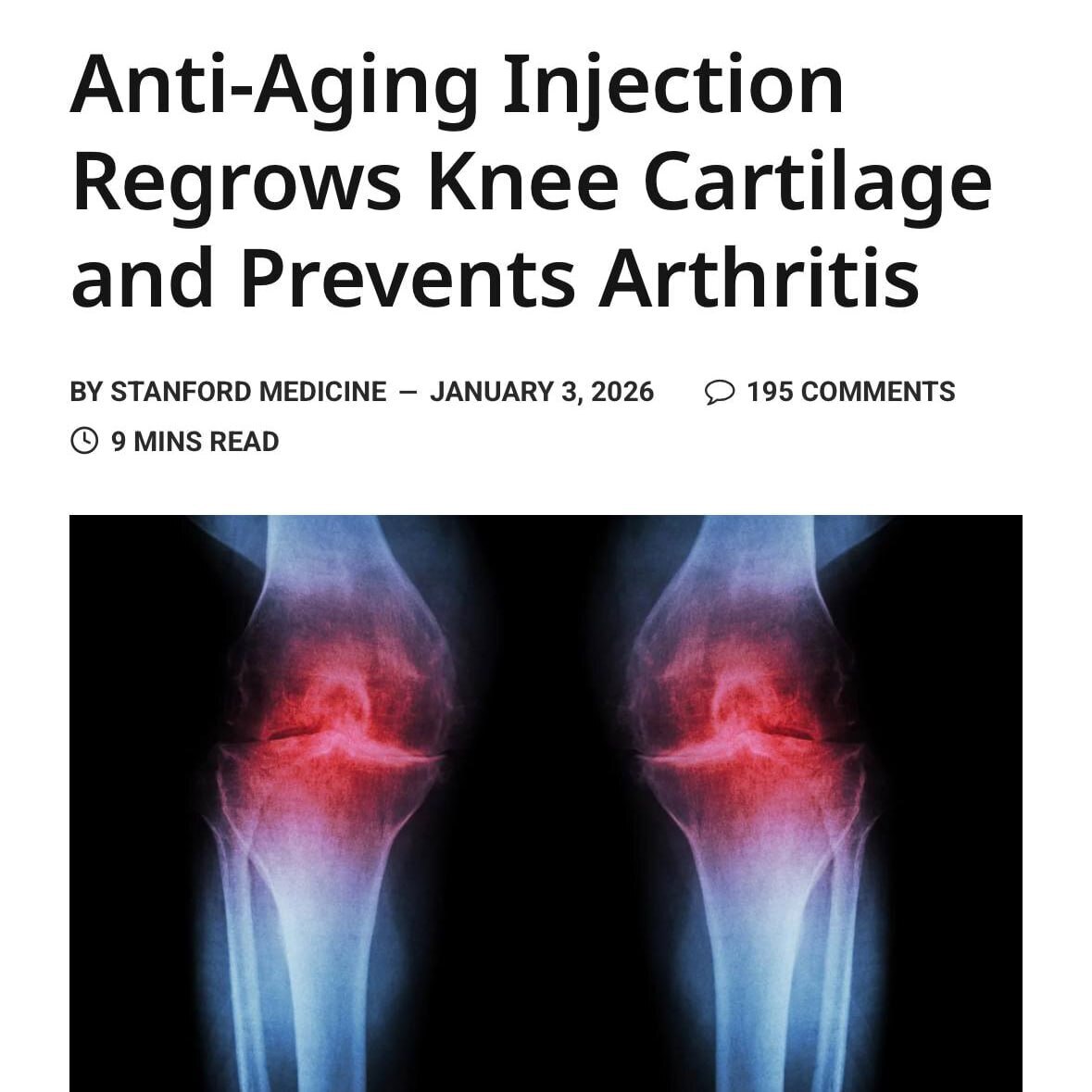 Учёные сделали важный шаг к решению проблемы болей в коленях — им удалось запустить восстановление хрящевой ткани непосредственно внутри сустава
